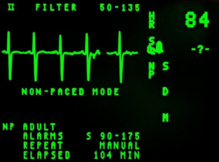 electrocardiogram, beat, cardiology, display, ekg, emergency, frequency, graph, heart, hospital, line, medical, medicine, monitor, pulse, rate, rhythm, screen, signal, ecg, black heart, black hospital, black medical, black medicine, black emergency, ekg, ekg, ekg, ekg, graph, hospital, hospital, medical, ecg, ecg, ecg, ecg, ecg